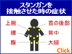 スタンガンを接触させた時の症状